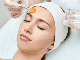 Chemical Peels